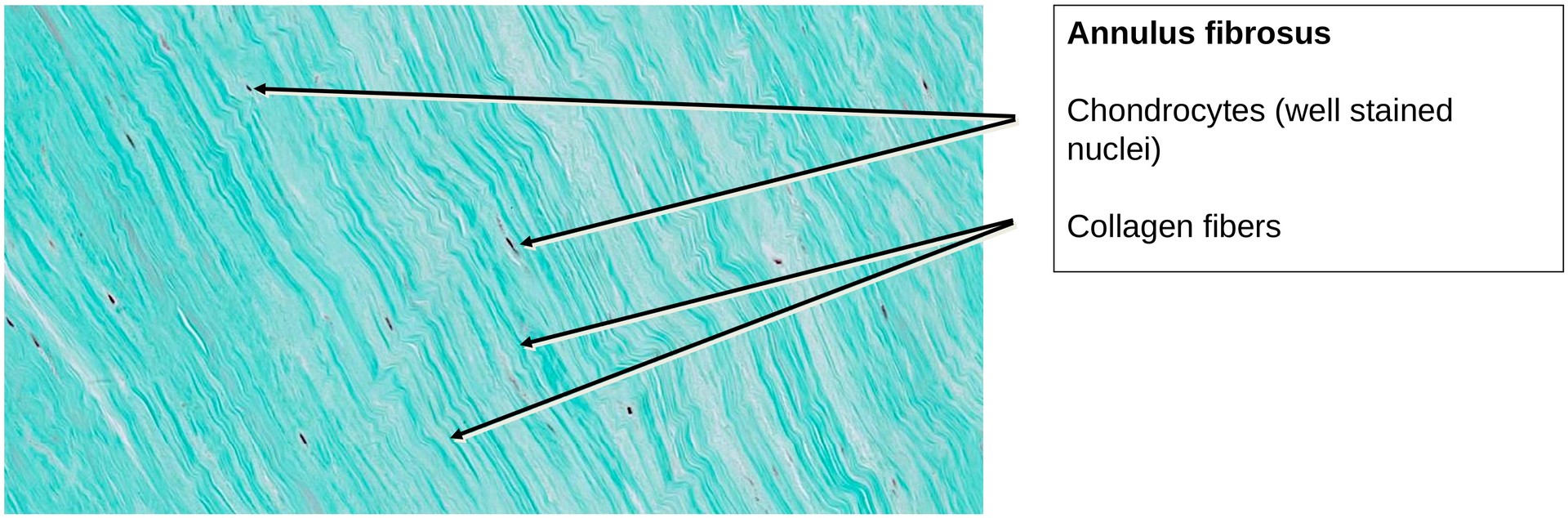 Fibrocartilage