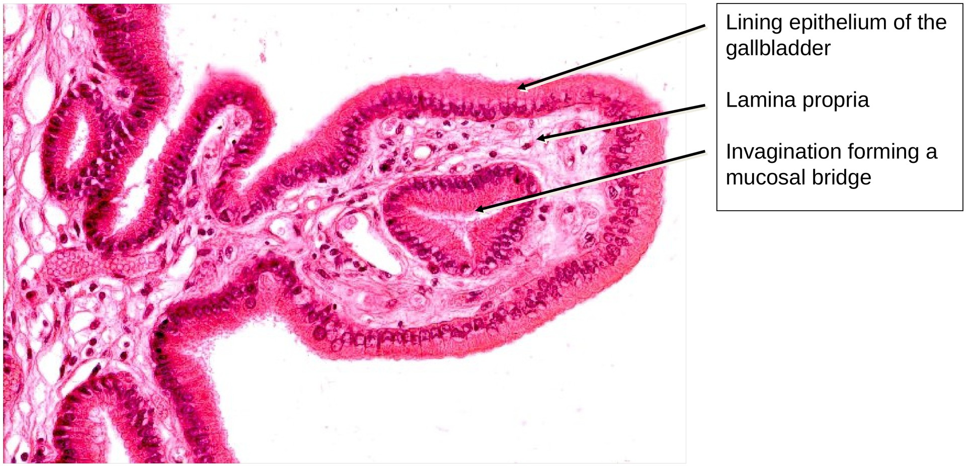 Gallbladder