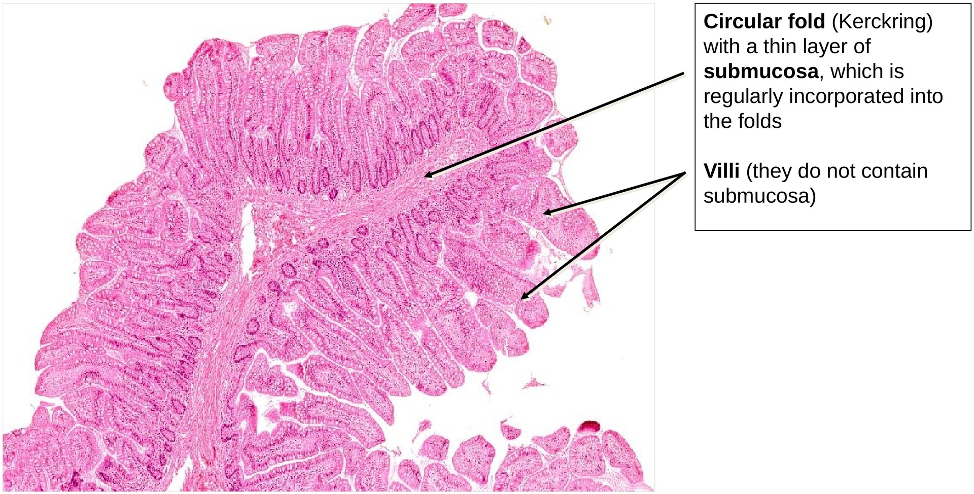 Ileum, Human 1