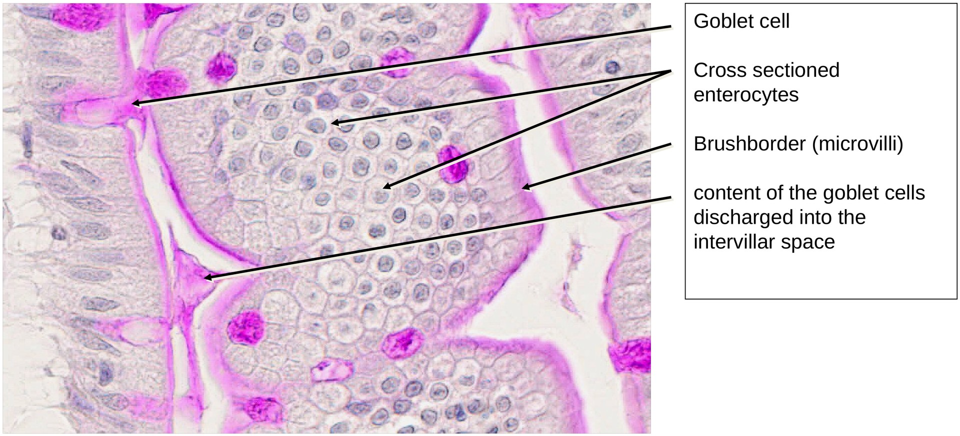 Jejunum, human 1