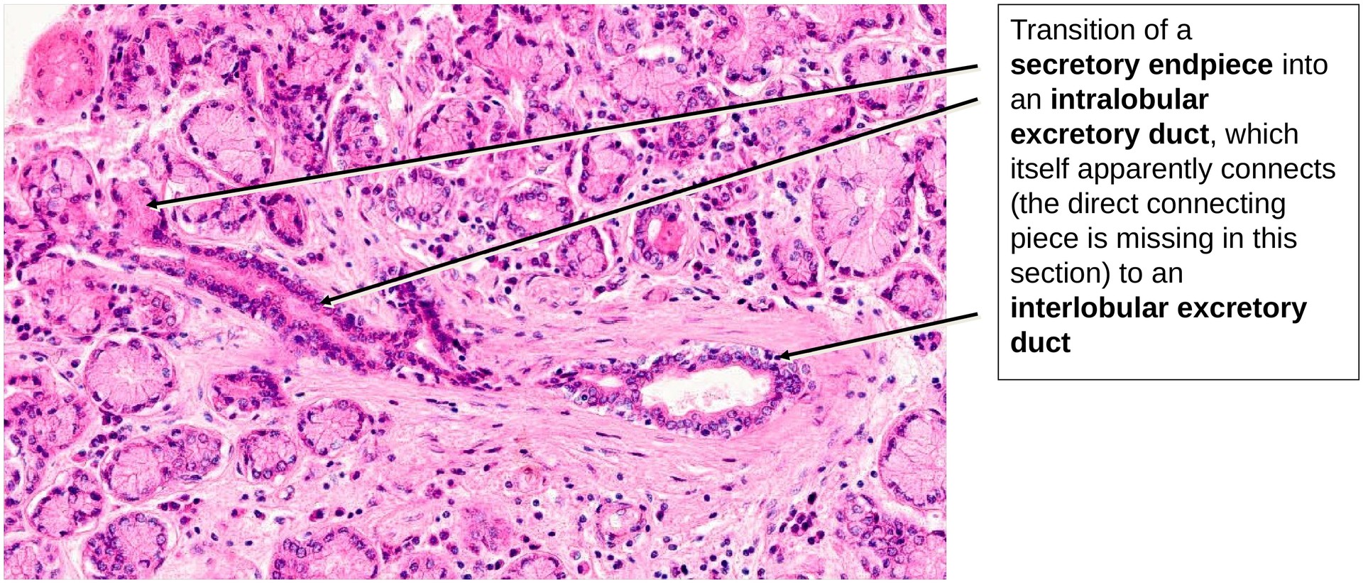 Lacrimal gland