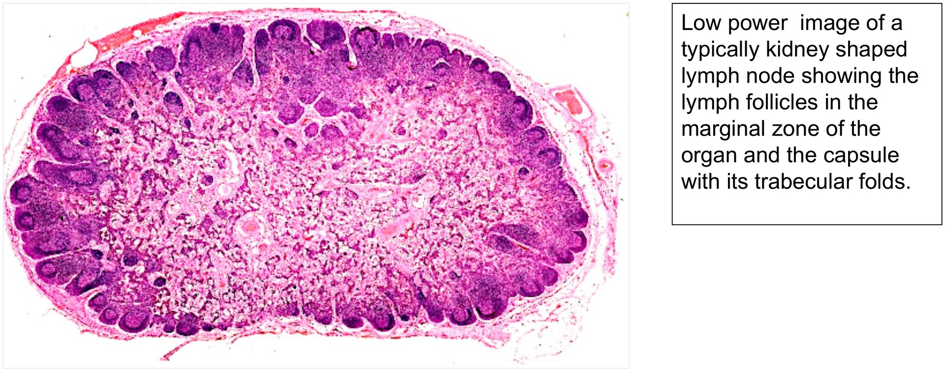 Lymph node, dog