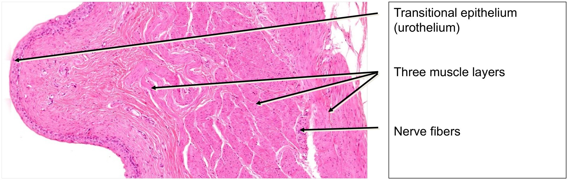 Urinary bladder