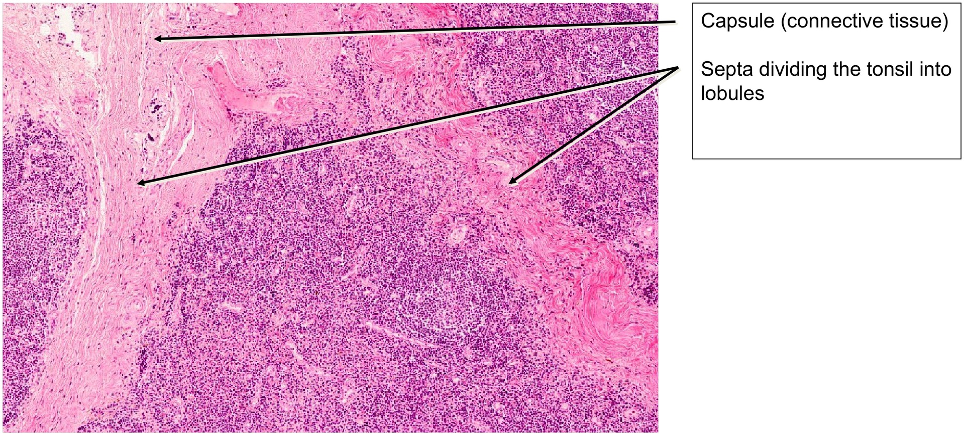 Palatine tonsil
