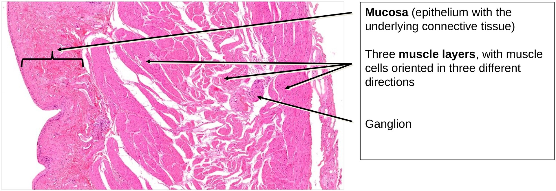 Transitional epithelium (urinary bladder)