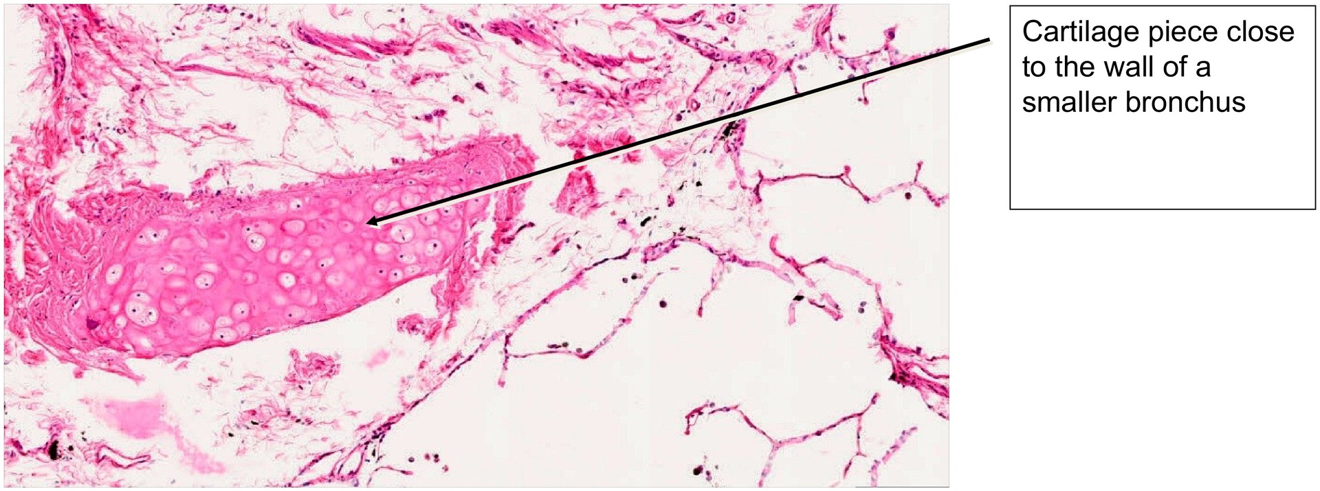 Lung adult
