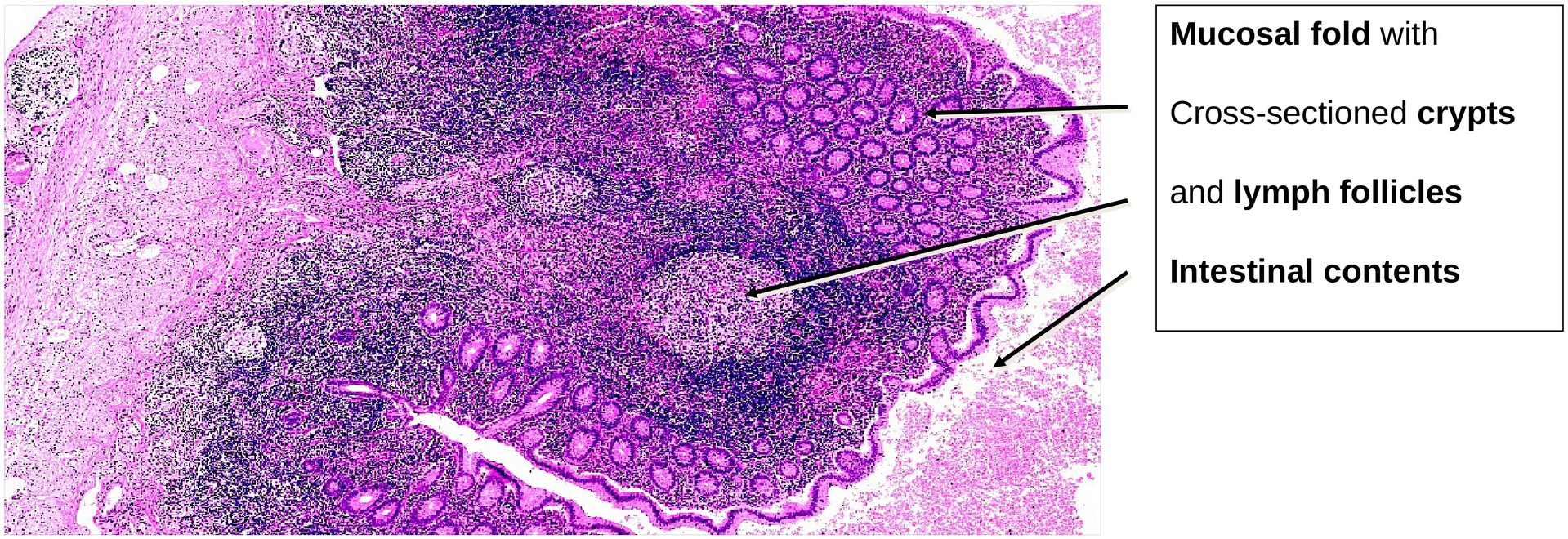 Vermiform appendix