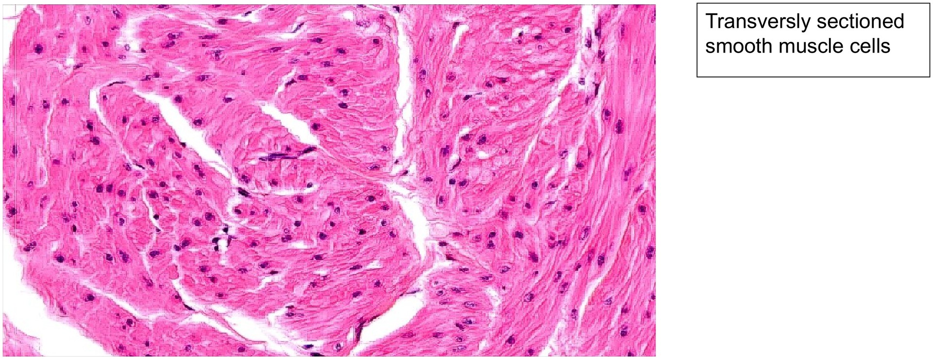 Urinary bladder