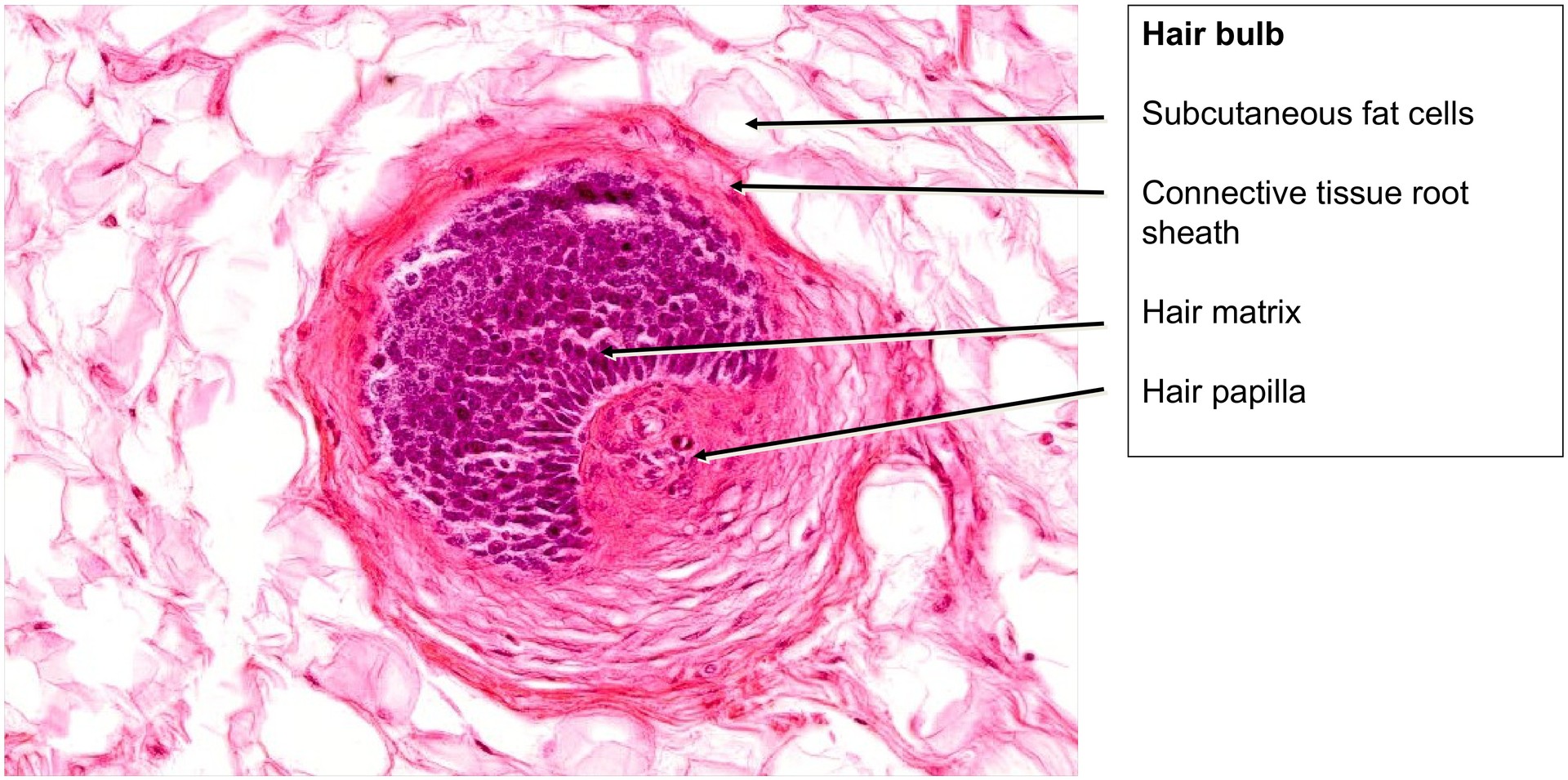 Scalp, cross