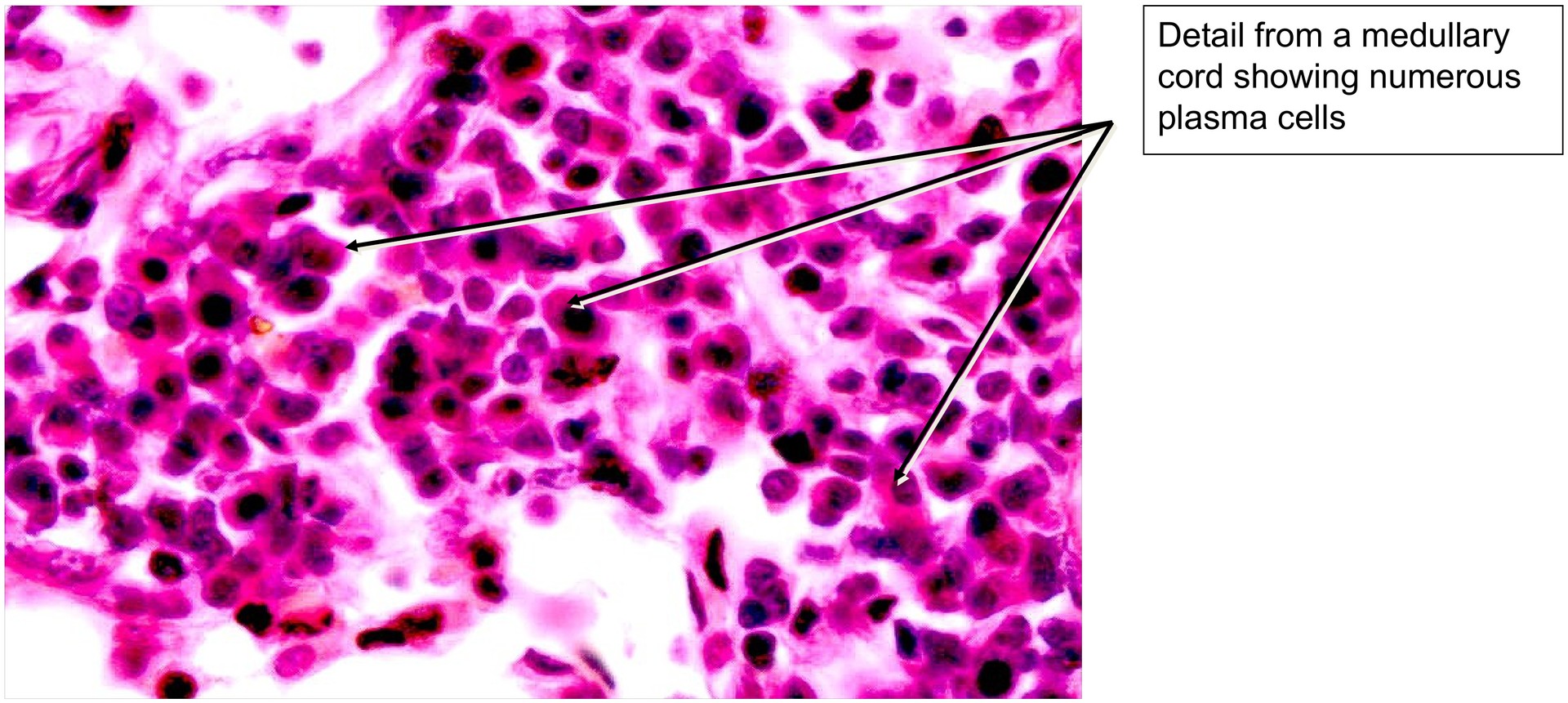 Lymph node, dog
