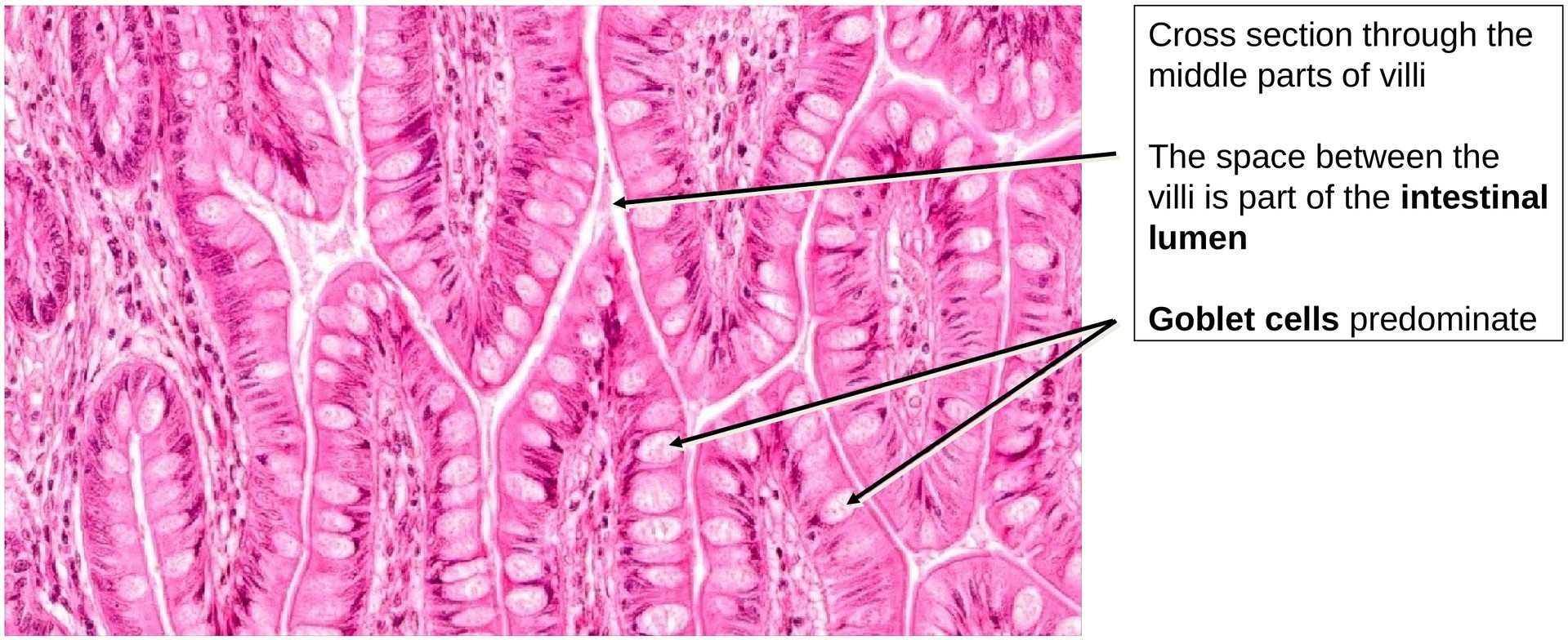 Ileum, Human 1