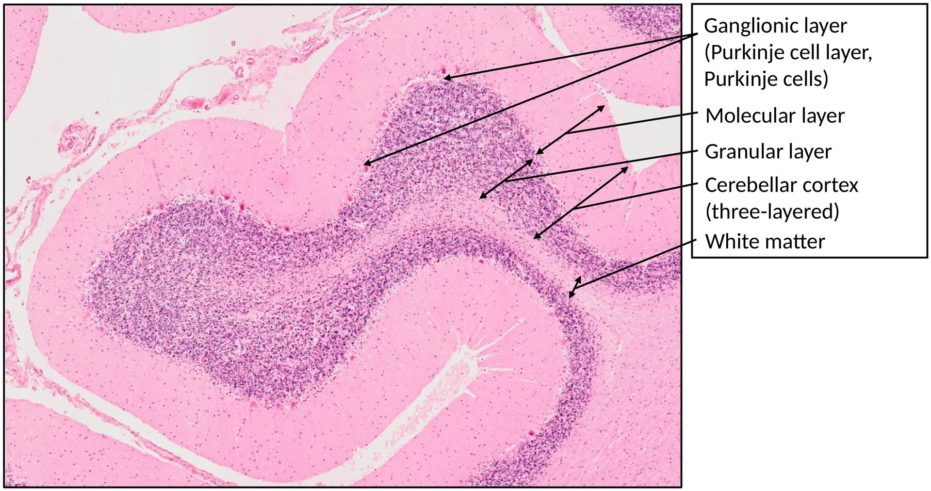 Cerebellum 1