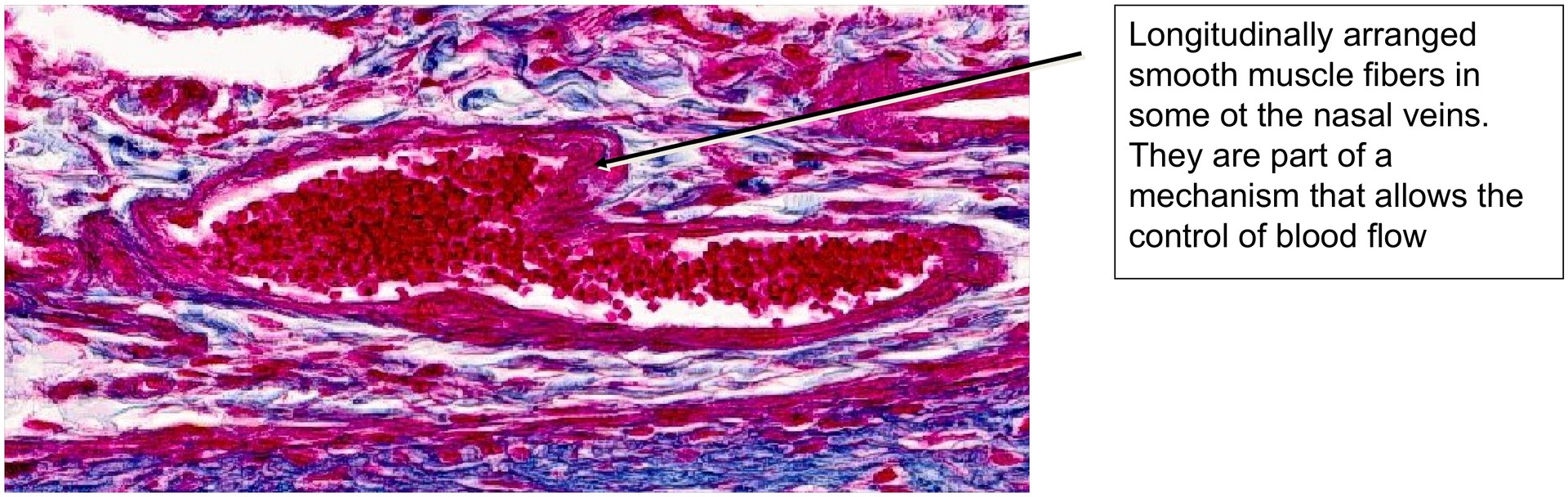 Nasal concha