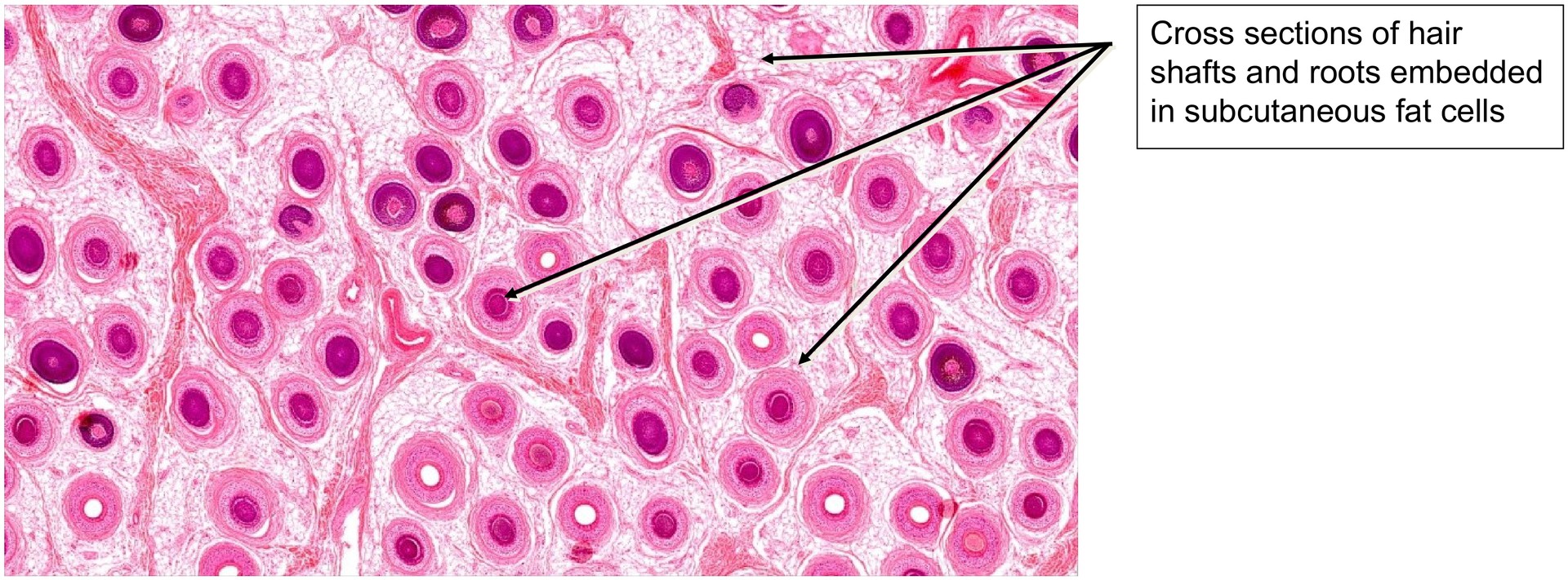 Scalp, cross