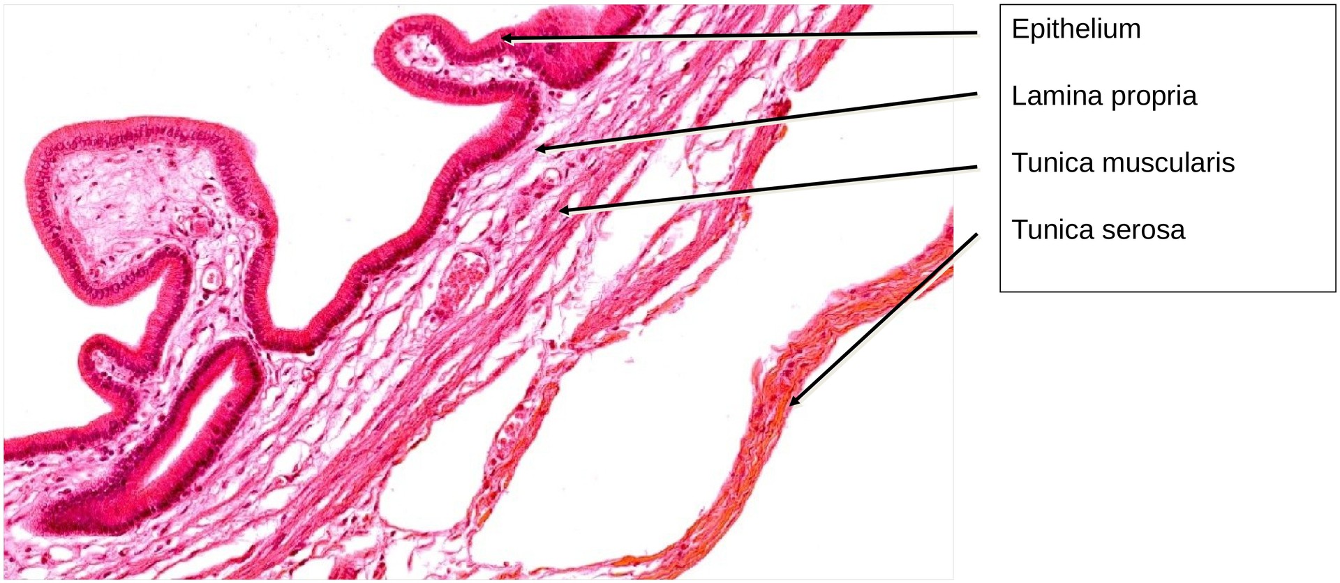Gallbladder