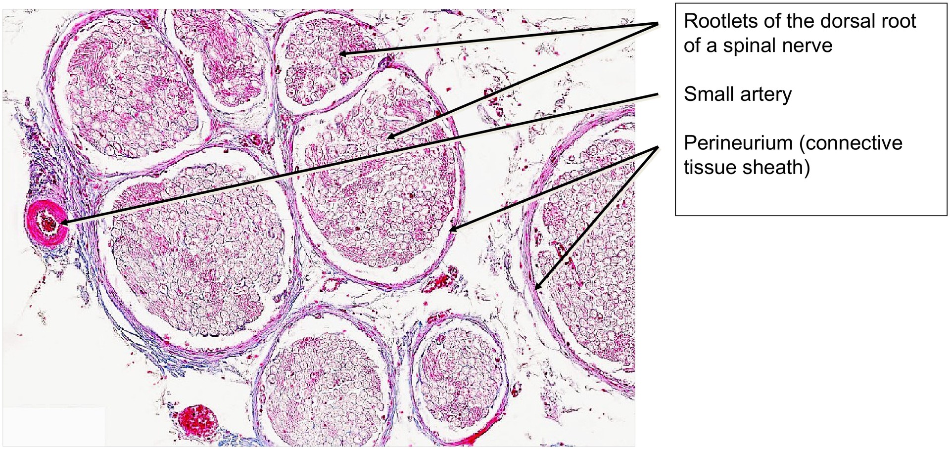 Spinal ganglion