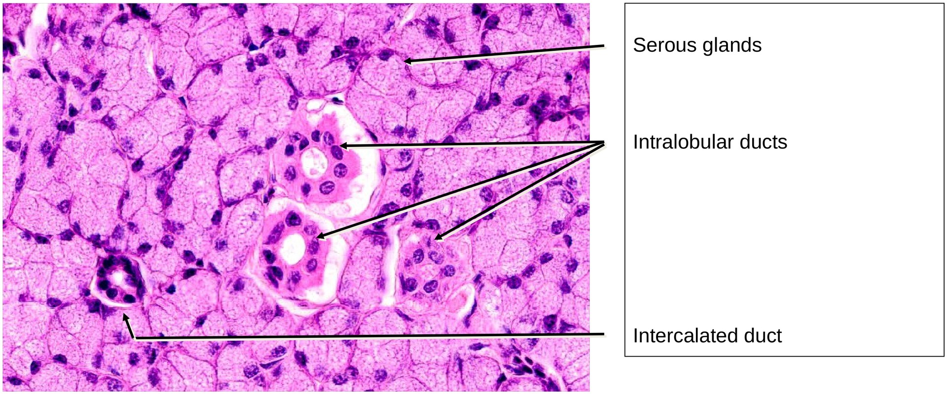 Parotid gland