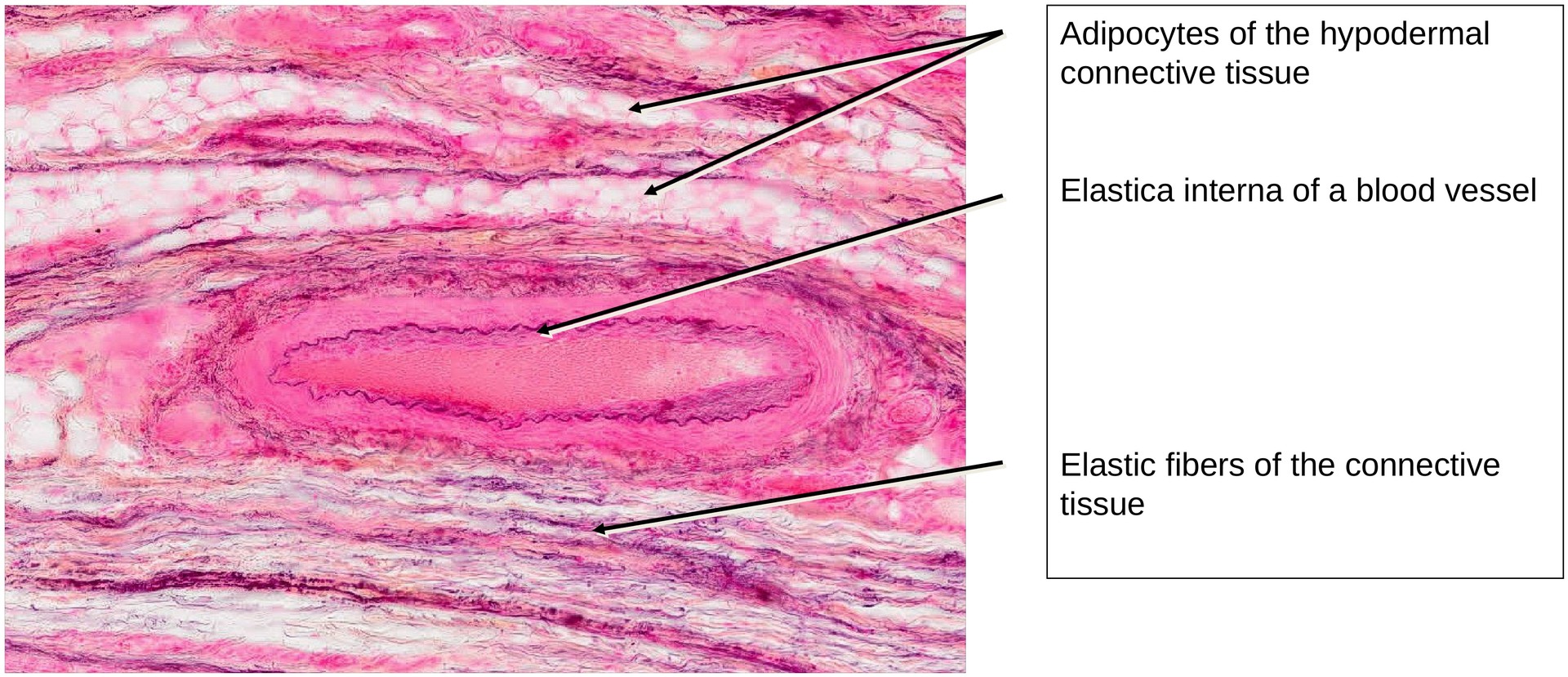 Elastic cartilage (Ear)