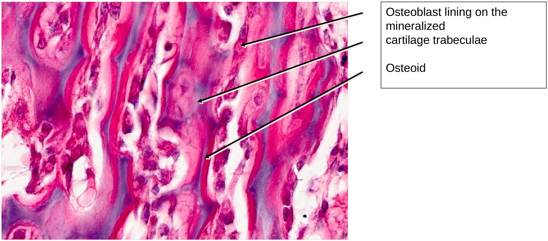 Ossification, endochondral