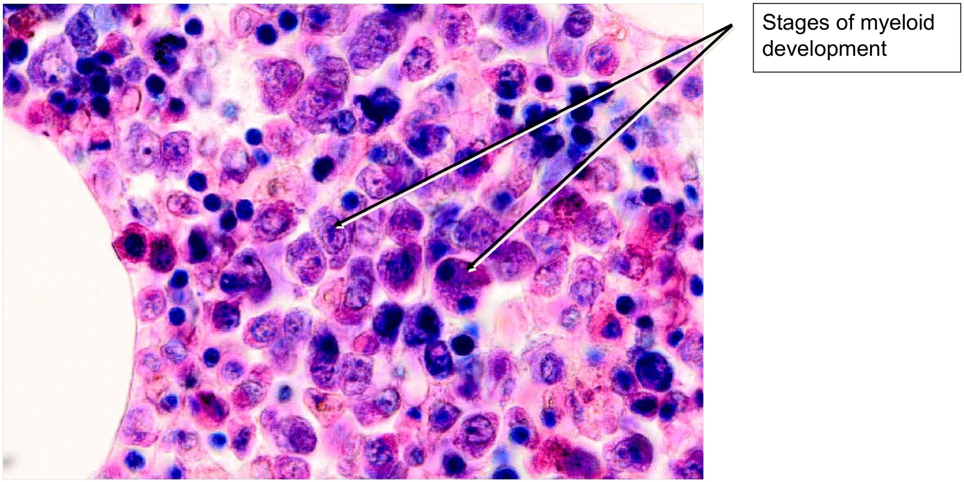 Bone marrow