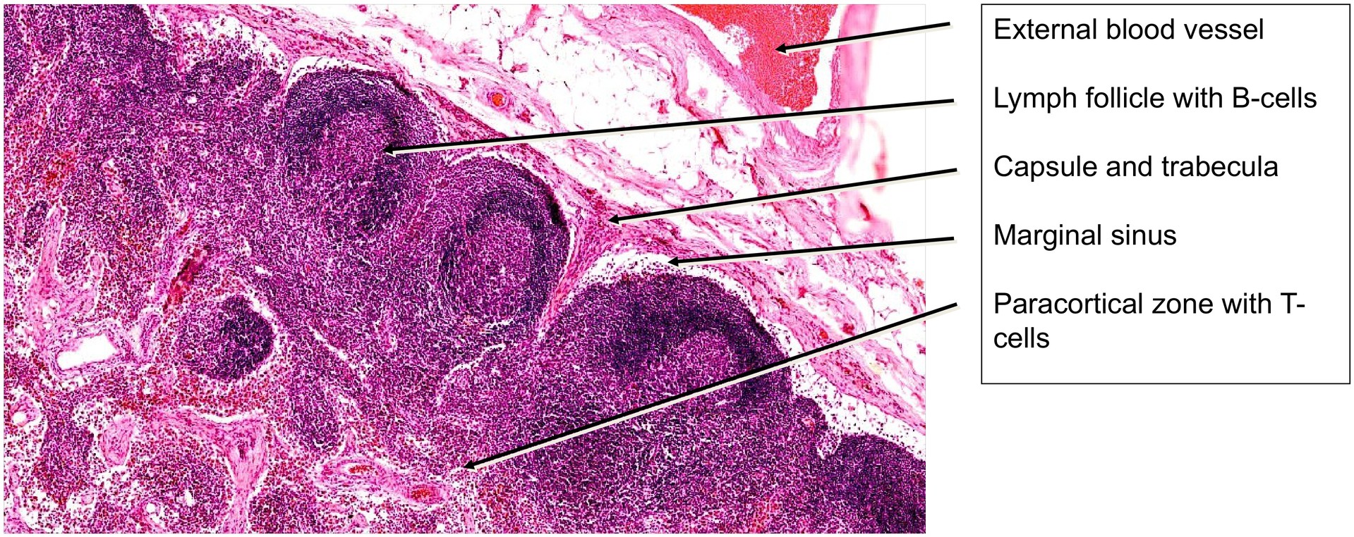 Lymph node, dog