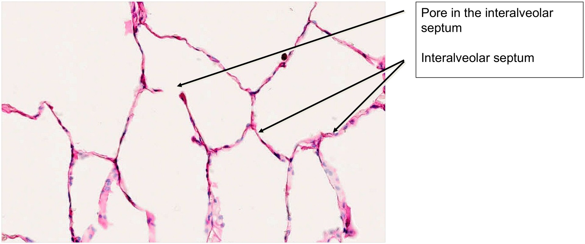 Lung adult