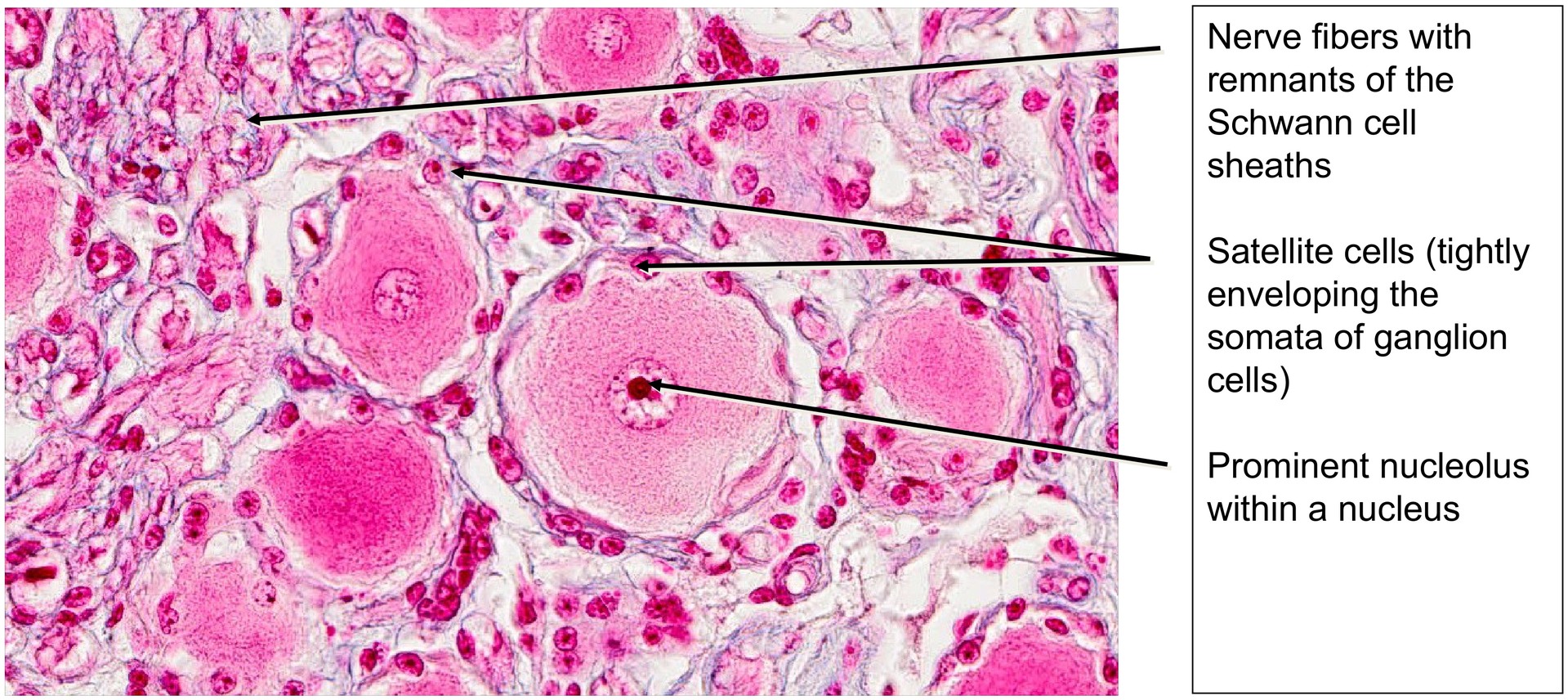 Spinal ganglion