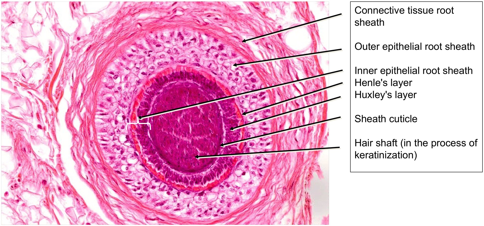 Scalp, cross