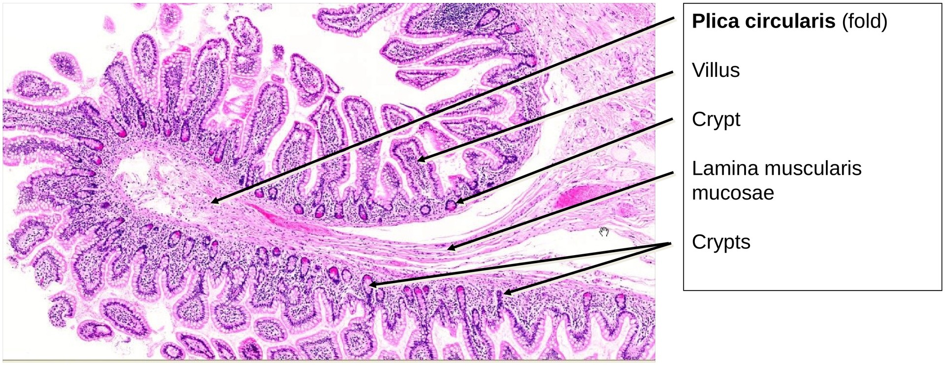 Ileum, Human 2