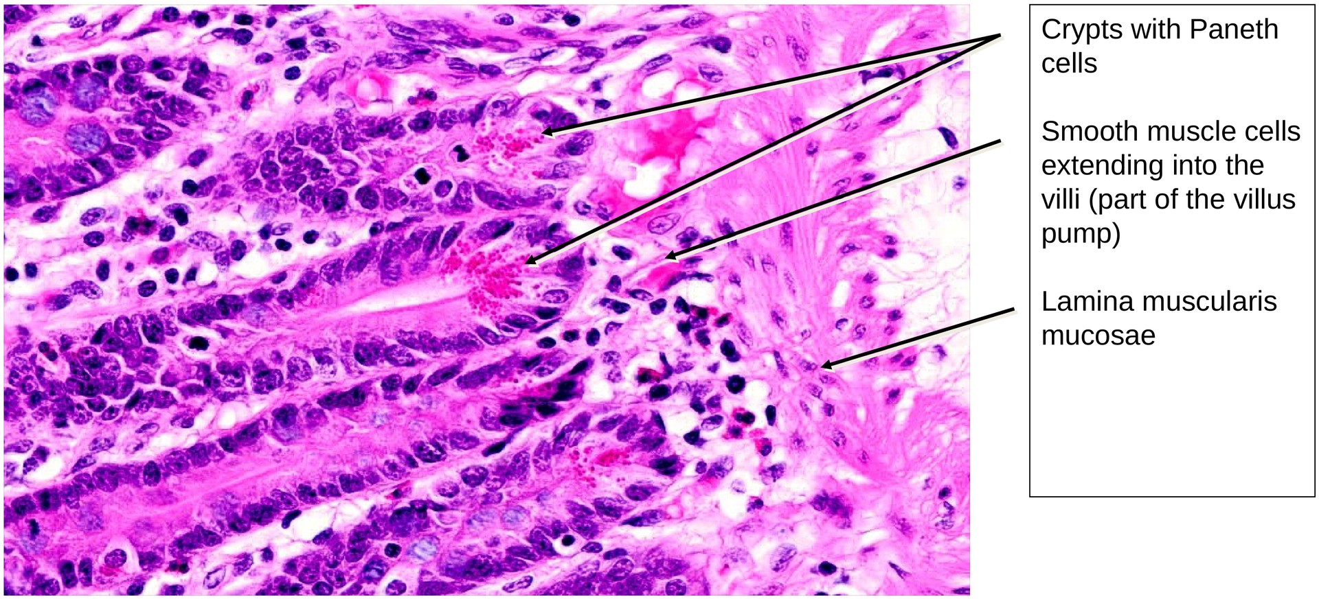 Jejunum, human 2