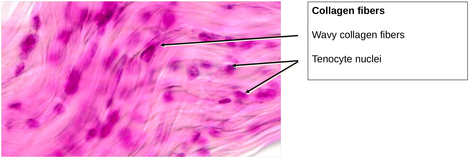 Collagen fibers (Tendon)