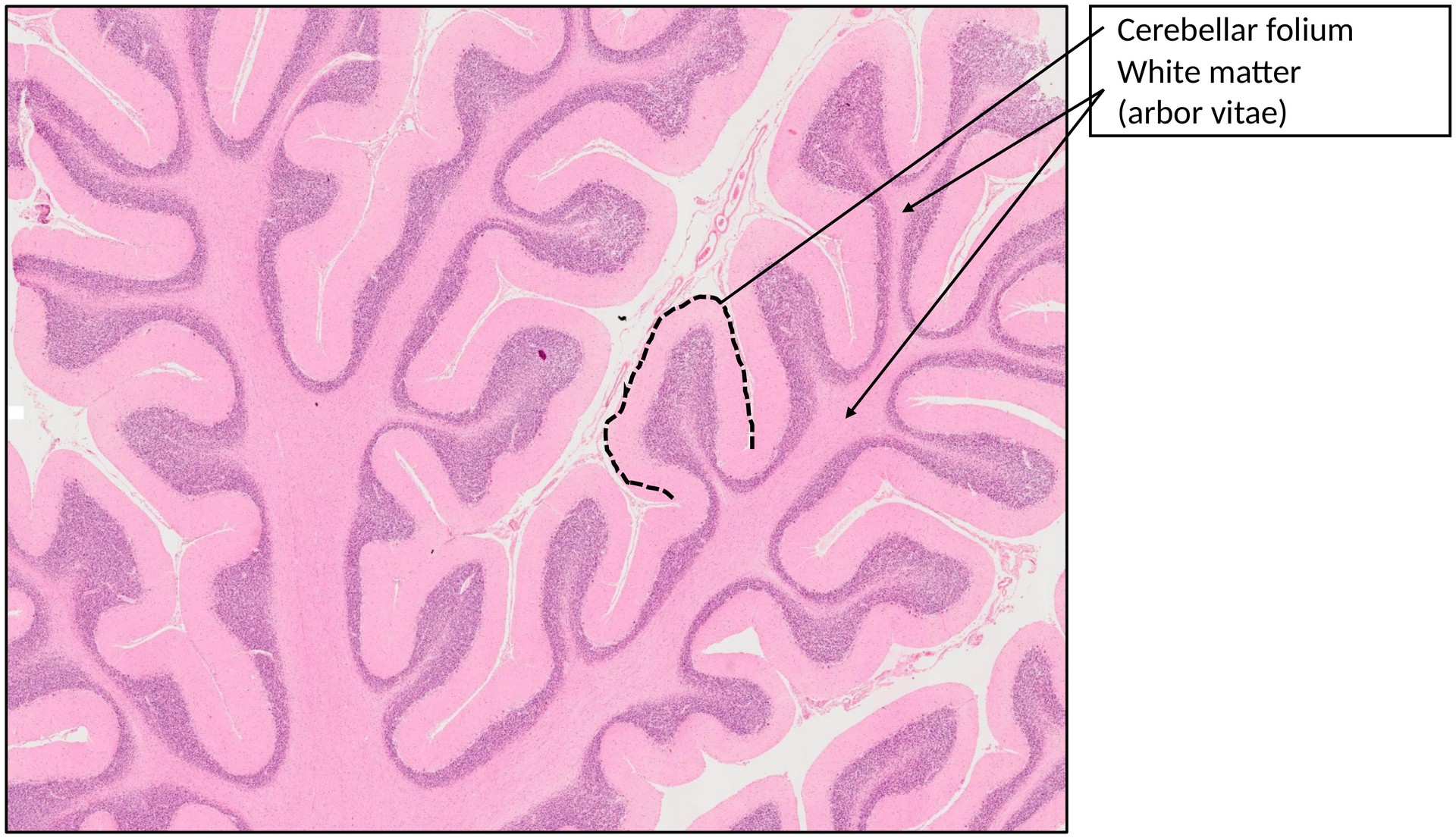 Cerebellum 1