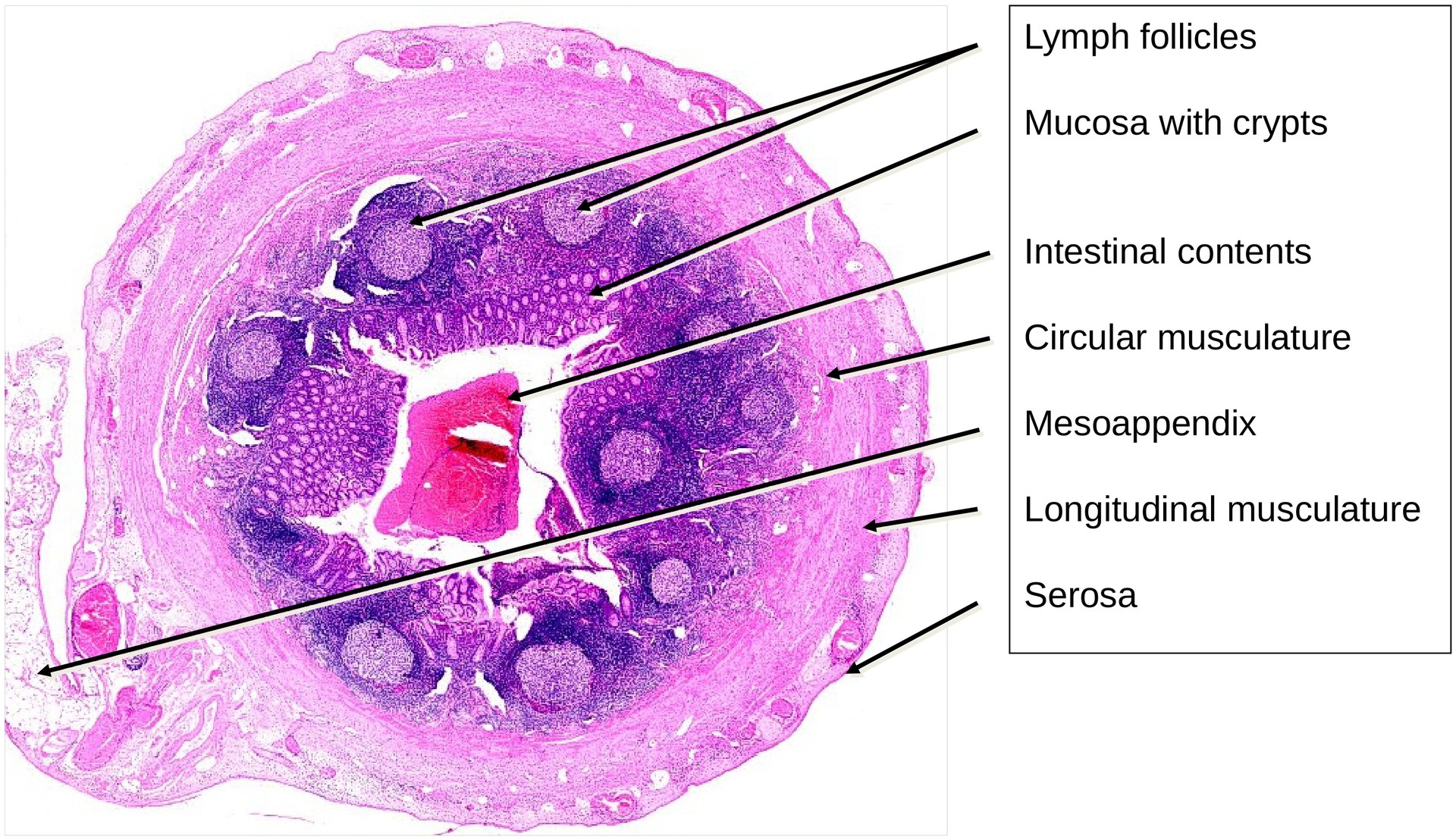 Vermiform appendix