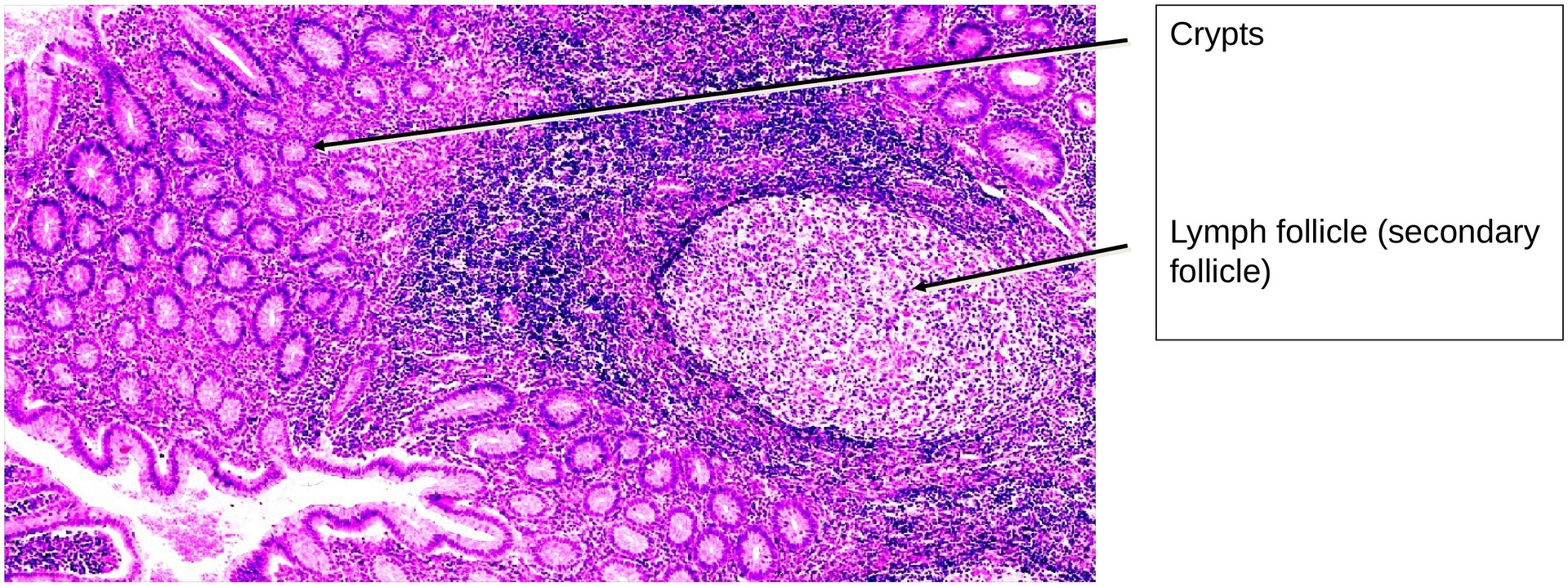 Vermiform appendix