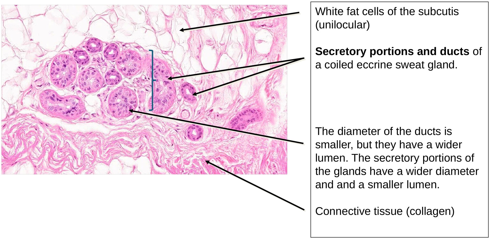 Keratinized stratified squamous epithelium (finger skin)
