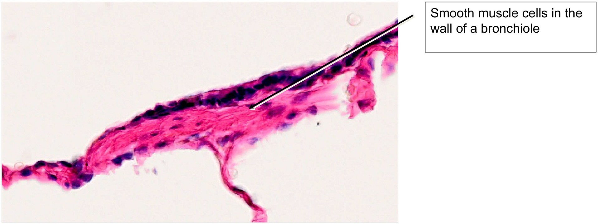 Lung adult