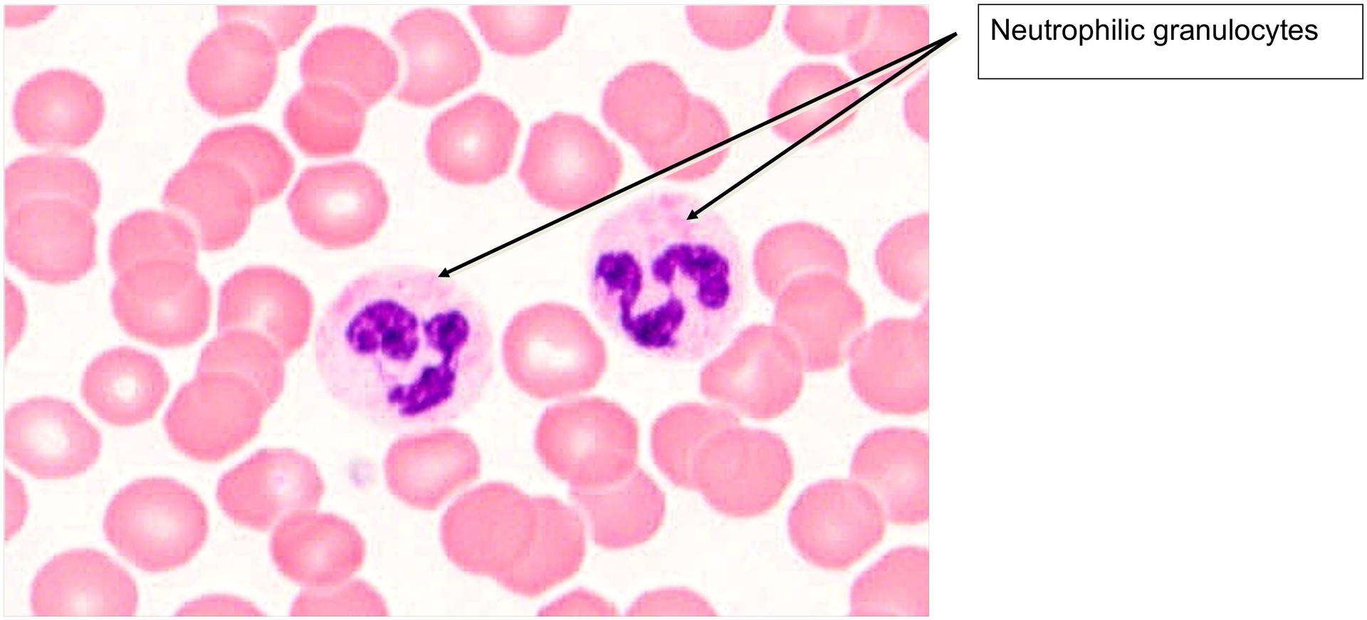 Blood smear