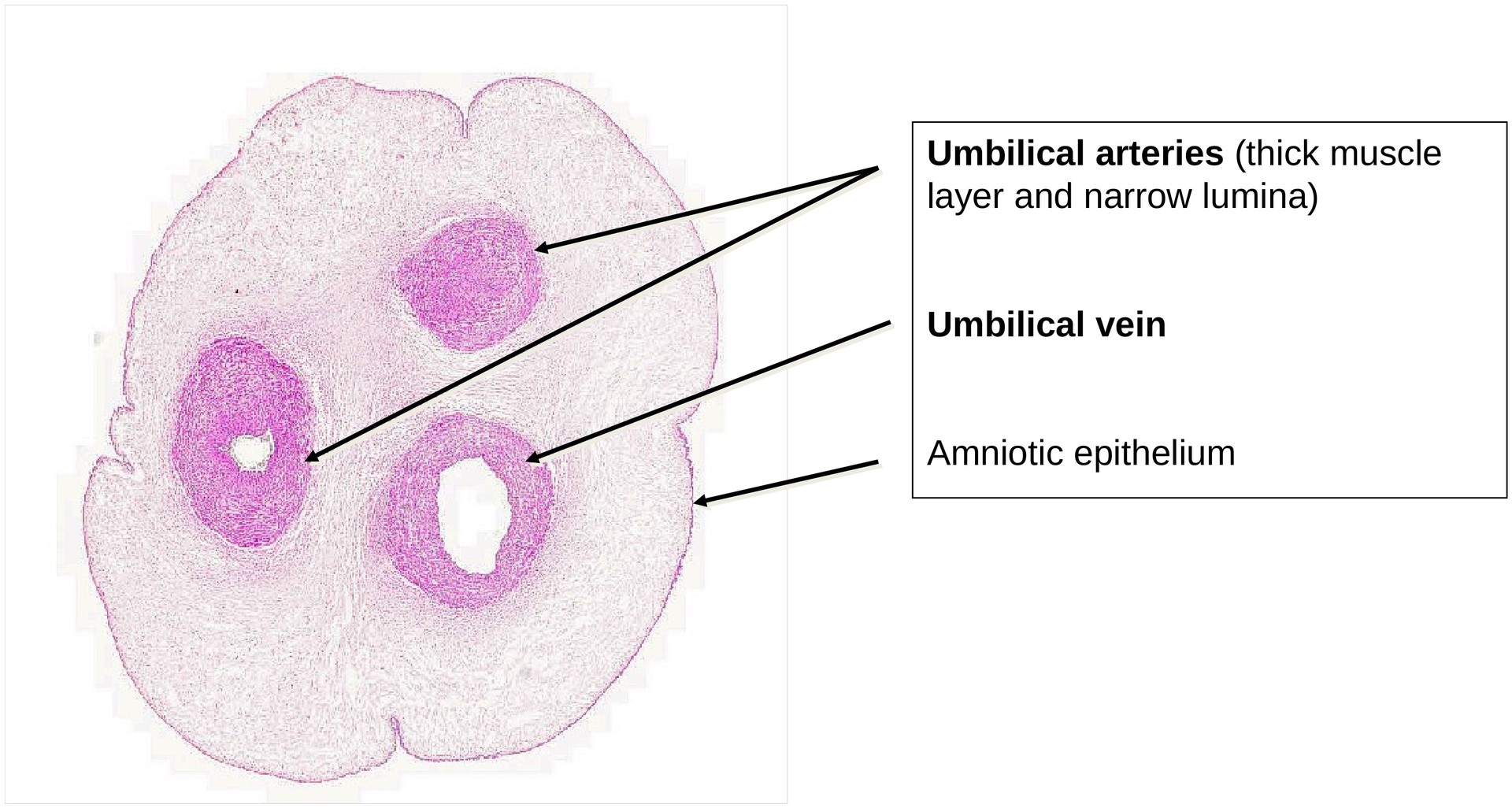 Fetal connective tissue (Umbilical Cord)