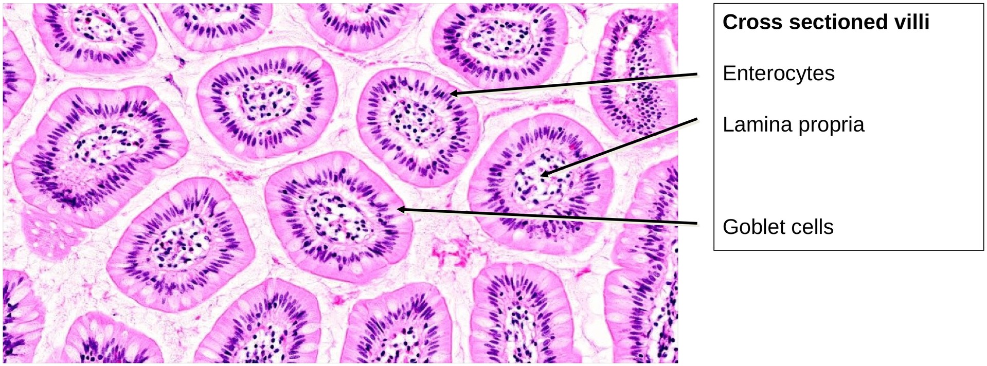 Ileum, Human 2