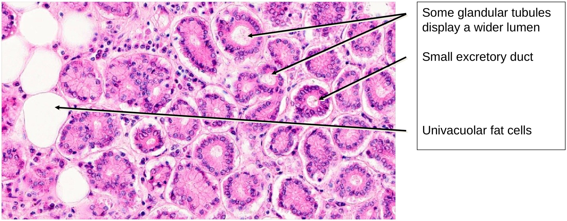 Lacrimal gland
