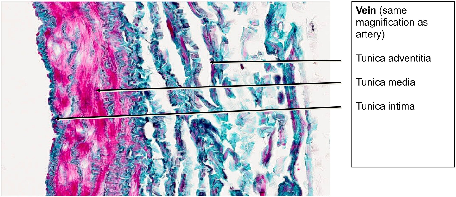 Artery Vein