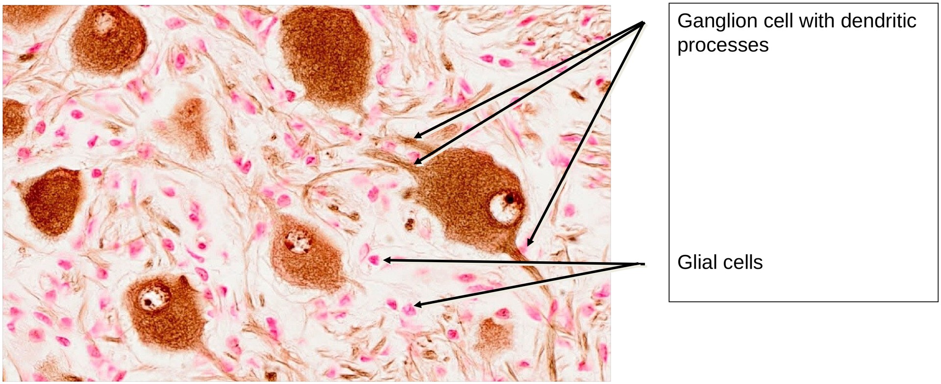 Sympathetic ganglion