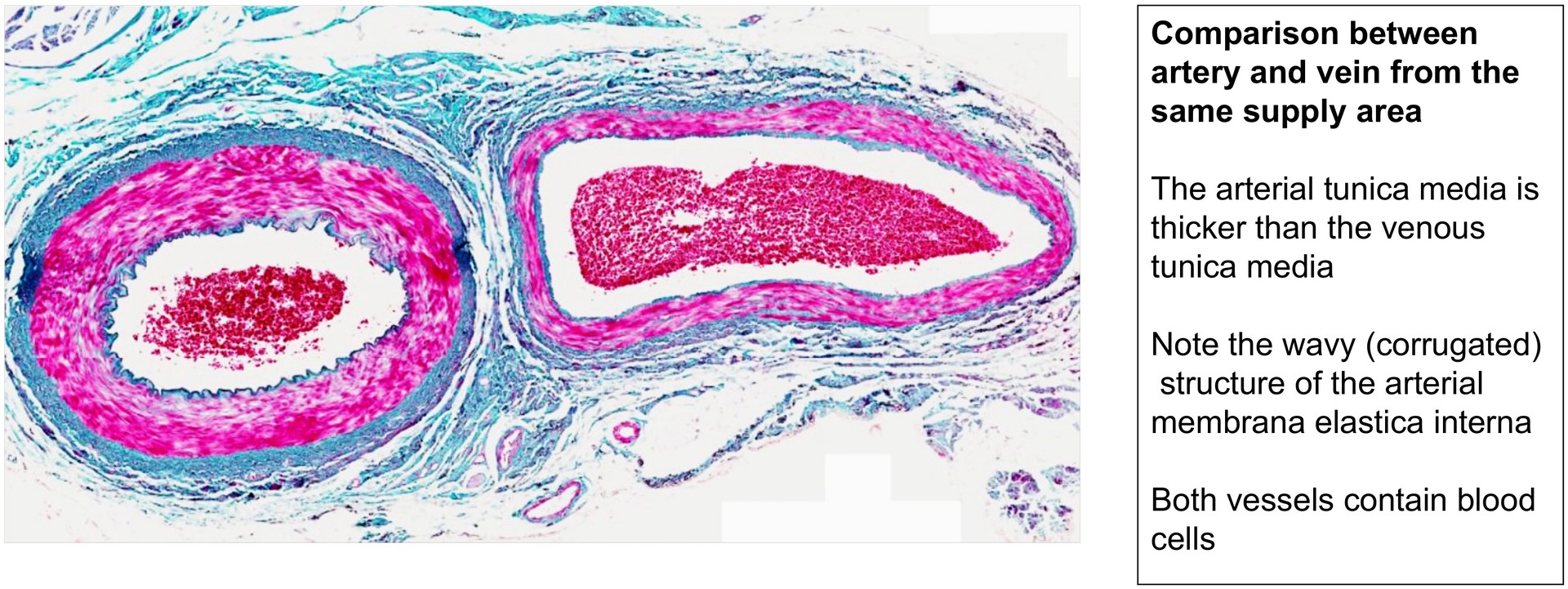 Artery Vein
