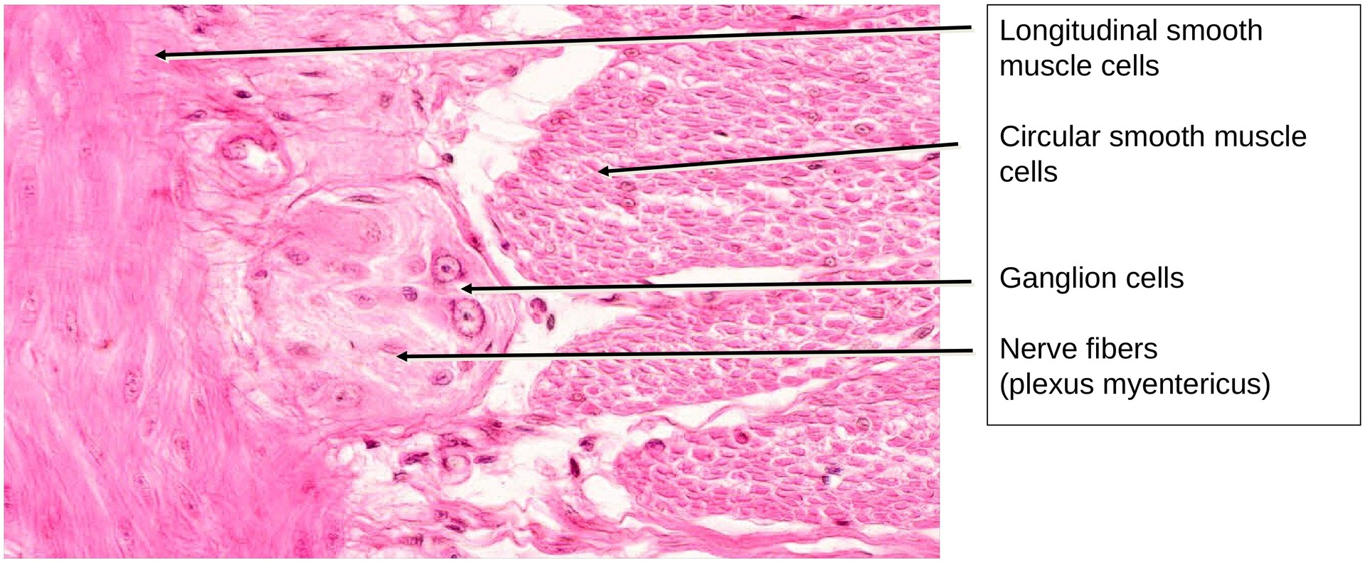 Ileum, Human 1