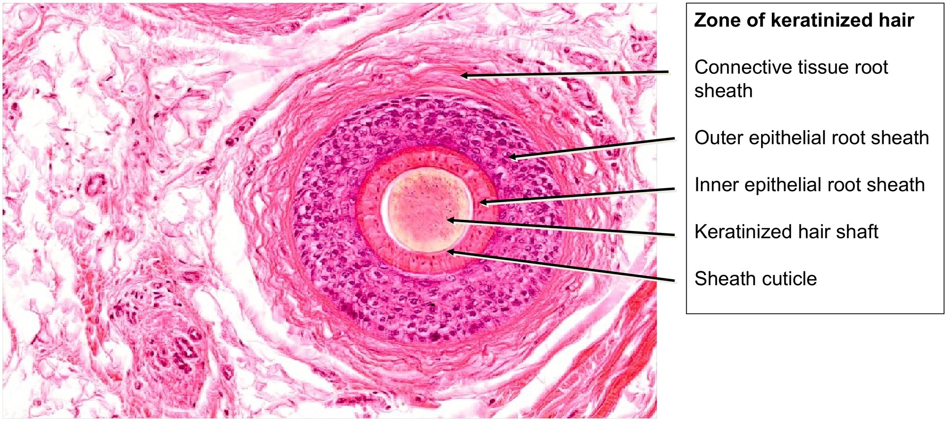 Scalp, cross