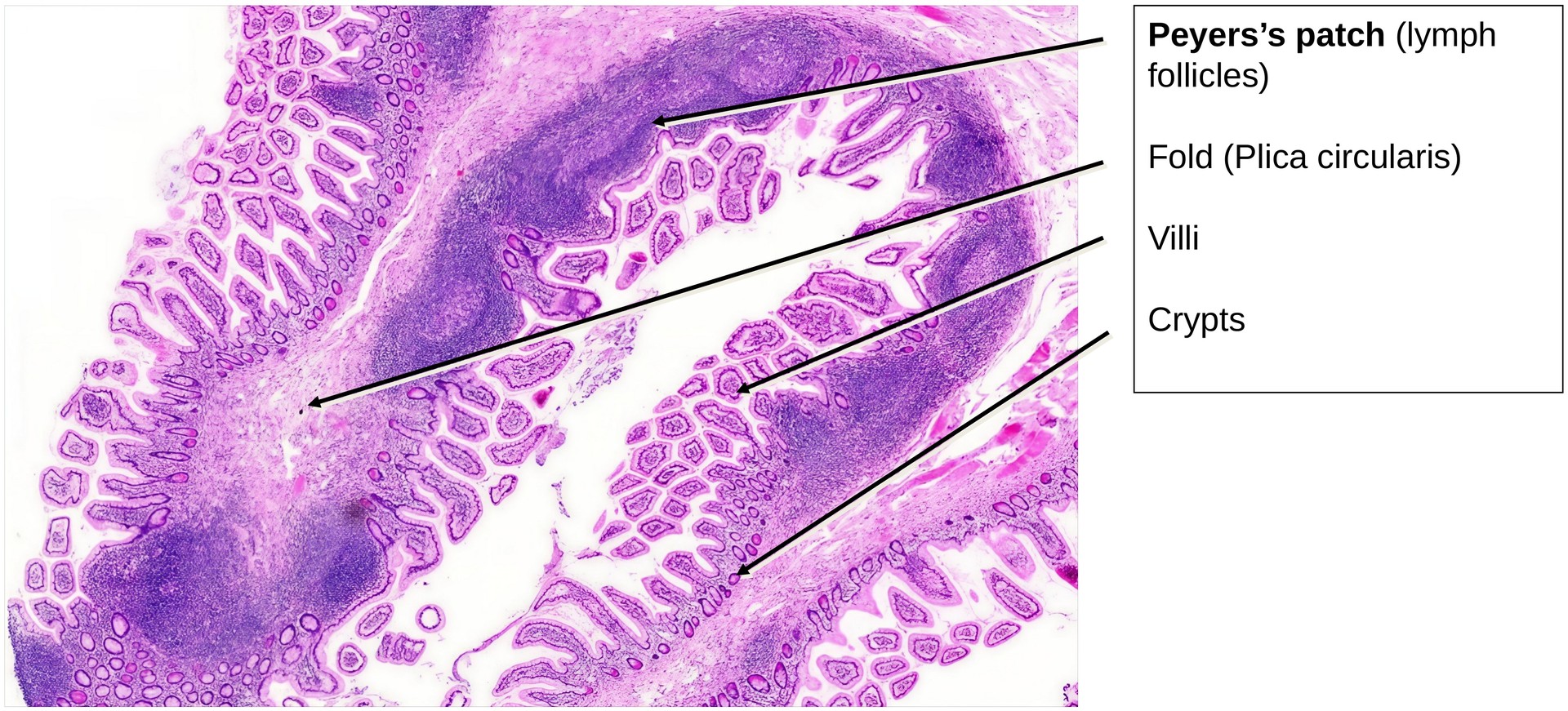 Ileum, Human 2