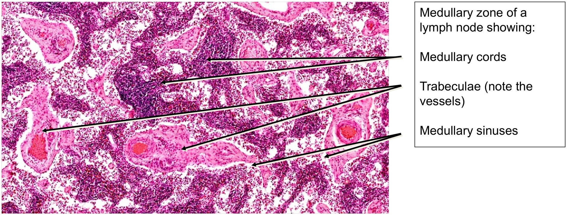 Lymph node, dog