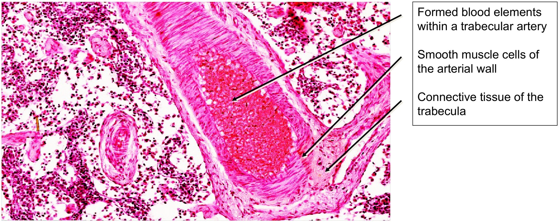 Lymph node, dog