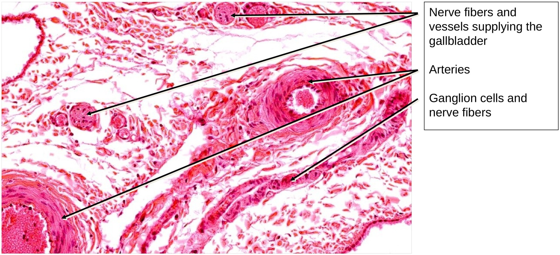 Gallbladder