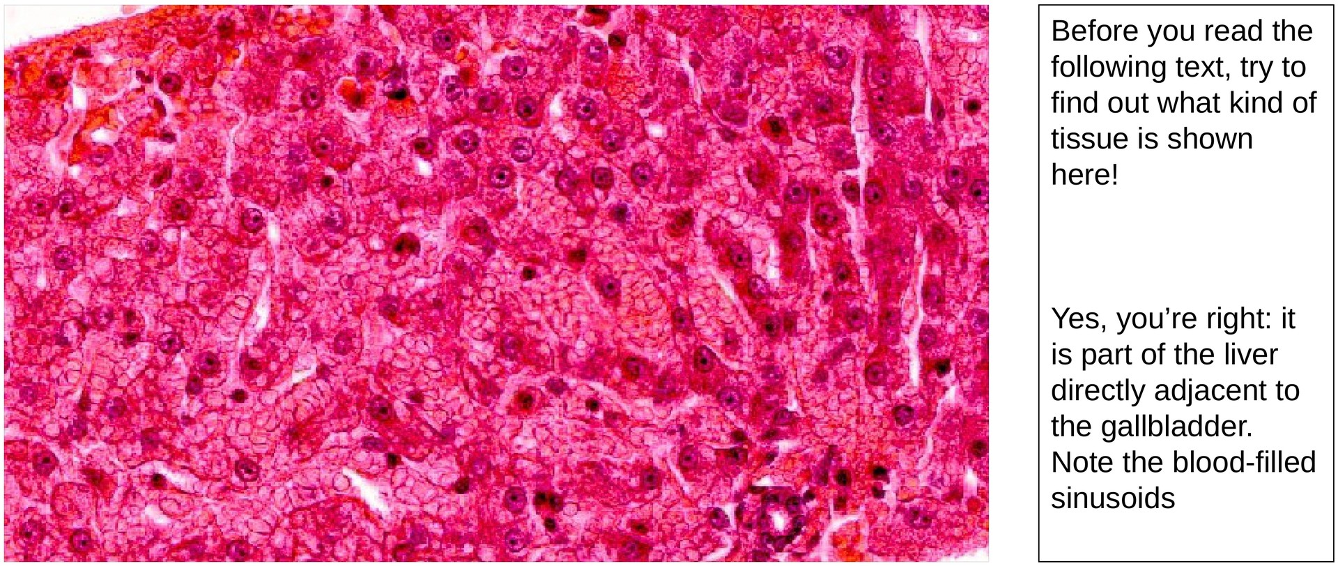 Gallbladder
